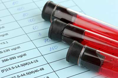 Blood Test Vials