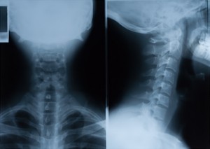 X-Ray of neck